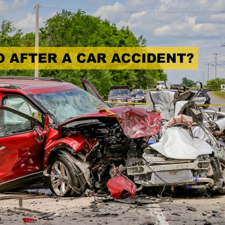 What Steps to Take Immediately After a Car Accident?
